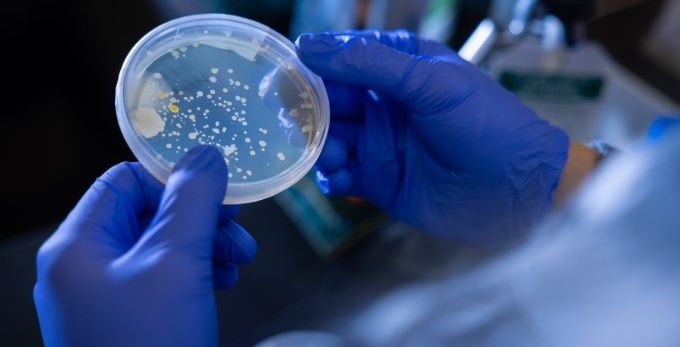Handen met blauwe handschoenen bekijken bacteriekolonies in een petrischaal